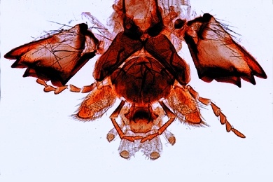 Mikropräparat - Vespa, Wespe, beißende Mundwerkzeuge eines Fleischfressers total