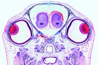 Mikropräparat - Junge Ratte, Kopf mit Augen, quer, Übersichtspräparat Mikropräparat - Junge Ratte, Kopf mit Augen, quer, Übersichtspräparat