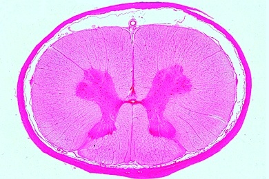 Mikropräparat - Rückenmark vom Säugetier, quer Mikropräparat - Rückenmark vom Säugetier, quer