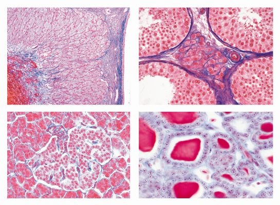 Mikropräparate - Hormone und Hormonfunktion, Sekundarstufe II, Serie IV, 7 Präparate mit Begleittext Mikropräparate - Hormone und Hormonfunktion, Sekundarstufe II, Serie IV, 7 Präparate mit Begleittext