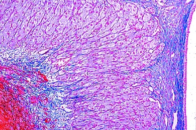 Mikropräparat - Eierstock vom Säugetier, quer, Gelbkörper (Corpus luteum) Mikropräparat - Eierstock vom Säugetier, quer, Gelbkörper (Corpus luteum)