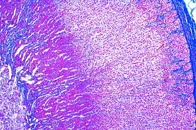 Mikropräparat - Nebenniere der Katze, quer, Rinde und Mark Mikropräparat - Nebenniere der Katze, quer, Rinde und Mark