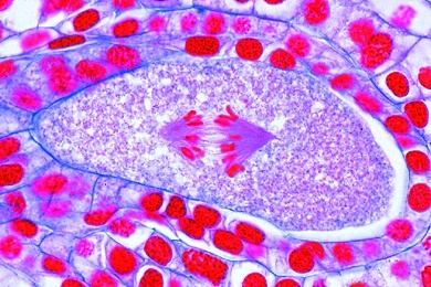 Mikropräparat - Lilie, Fruchtknoten quer, Embryosackentwicklung Mikropräparat - Lilie, Fruchtknoten quer, Embryosackentwicklung