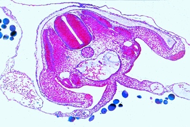 Mikropräparat - Huhnentwicklung, Embryo 72 Stunden alt, quer Mikropräparat - Huhnentwicklung, Embryo 72 Stunden alt, quer