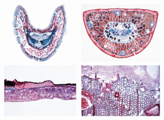 Mikropräparate - Unsere Umwelt I, Der Wald, Ursache und Wirkung von Waldschäden,  20 Präparate mit Begleittext