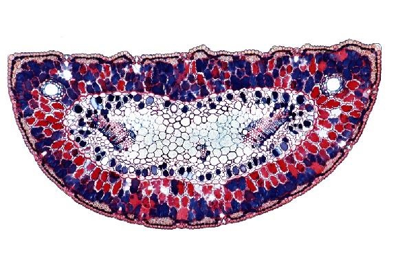 Mikropräparat - Gesunde Kiefernadel, quer