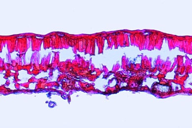 Mikropräparat - Geschädigtes Buchenblatt, quer, Zellschäden, verursacht durch Schwefeldioxid