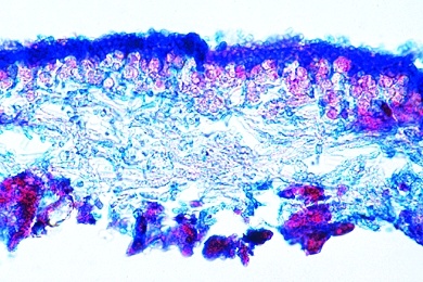 Mikropräparat - Durch Luftverschmutzung zerstörte Flechte, quer
