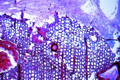 Mikropräparat - Holzzerstörender Pilz, Schnitt durch einen befallenen Holzstamm