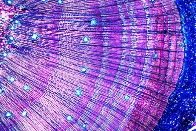 Mikropräparat - Holz mit engen Jahresringen infolge Trockenheit, quer