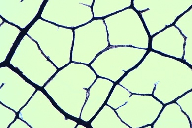 Mikropräparat - Verrottendes Laubblatt, Äderung. Humusbildung