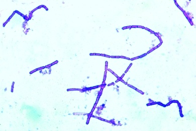 Mikropräparat - Bodenbakterien (Bacillus megaterium), Ausstrich