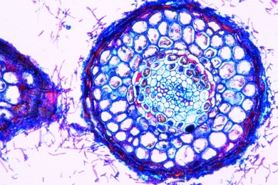 Mikropräparat - Baumwurzel mit Pilzhülle, quer. Wurzelpilze