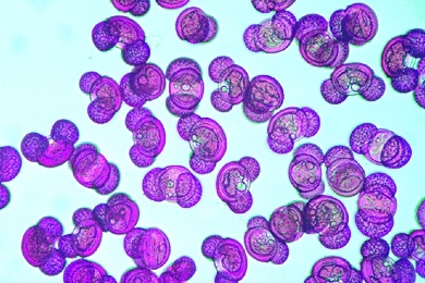 Mikropräparat - Pollenkörner von Nadelbäumen