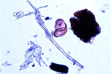 Mikropräparat - Gemisch von Hausstaub
