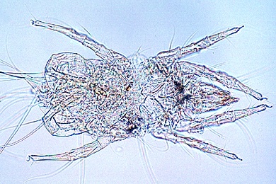 Mikropräparat - Staubmilben aus einer Wohnung