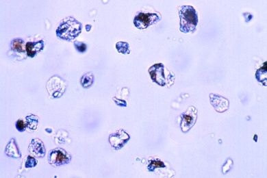 Mikropräparat - Asbeststaub (krebserregend)