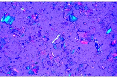 Mikropräparat - Talkumpuder