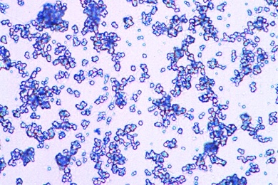 Mikropräparat - Waschmittelkristalle