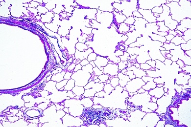 Mikropräparat - Gesunde Lunge des Menschen mit Lungenbläschen, quer