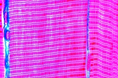 Mikropräparat - Skelettmuskulatur, längs. Querstreifung, Myofibrillen, Kerne