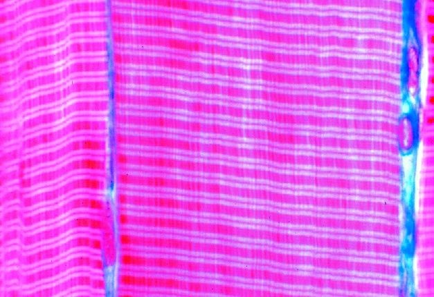 Mikropräparat - Skelettmuskulatur, längs. Querstreifung