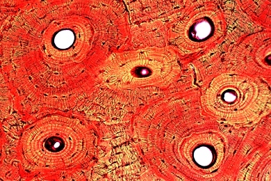 Mikropräparat - Knochen vom Rind, quer, Knochenzellen, Lamellensysteme