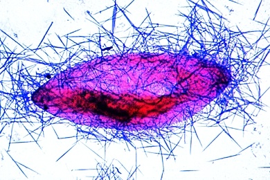 Mikropräparat - Paramaecium, Trichocysten, Darstellung durch Karbolfuchsin