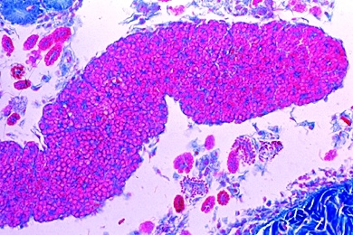 Mikropräparat - Regenwurm, Geschlechtsregion mit Hoden, quer