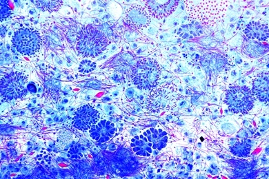 Mikropräparat - Regenwurm, Spermatozoen, Ausstrich. Entwicklungsstadien