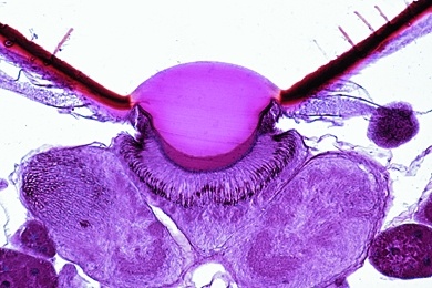 Mikropräparat - Honigbiene, Punktaugen (Ocellen), total