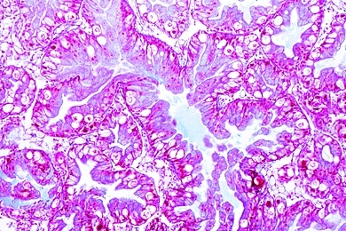 Mikropräparat - Weinbergschnecke, Mitteldarmdrüse, quer, Leberzellen, Kalkzellen