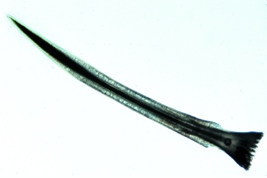 Mikropräparat - Weinbergschnecke, Liebespfeilsack und fingerförmige Drüsen, quer