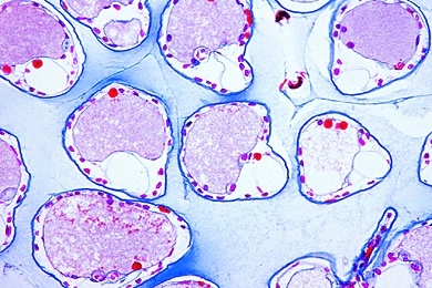 Mikropräparate - Der Flußkrebs (Astacus fluviatilis), 12 Präparate