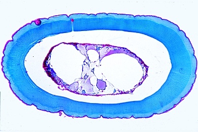 Mikropräparat - Flußkrebs, Antenne quer, Chitinpanzer, Außenskelett der Krebse