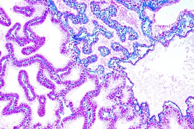 Mikropräparat - Flußkrebs, Grüne Drüse (Antennendrüse) quer. Exkretionsorgan
