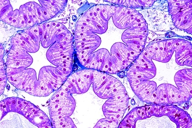 Mikropräparat - Flußkrebs, Mitteldarmdrüse (Leber) quer, Blasen- und Fibrinzellen
