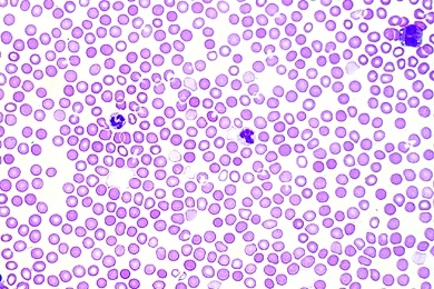 Mikropräparat - Kaninchen, Blut, Ausstrich