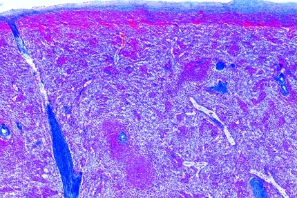 Mikropräparat - Kaninchen, Milz, quer