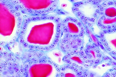 Mikropräparat - Kaninchen, Schilddrüse, quer