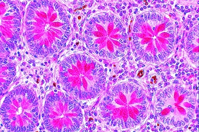 Mikropräparat - Kaninchen, Enddarm mit Schleimzellen, quer