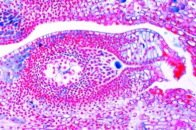 Mikropräparat - Kiefer, Nucellus mit heranwachsendem weibl. Gametophyten, längs