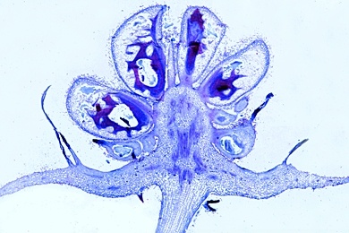 Mikropräparat - Himbeere, Sammelsteinfrucht längs