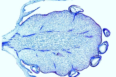 Mikropräparat - Erdbeere, Sammelnußfrucht längs