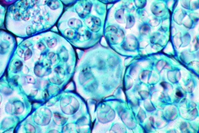 Mikropräparat - Scharbockskraut (Ranunculus ficaria), stärkehaltige Wurzelknöllchen