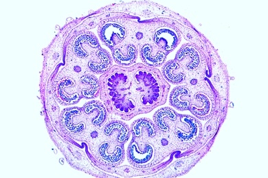 Mikropräparat - Kartoffel, Blüte quer