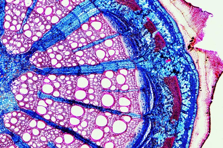 Mikropräparate - Bäume und Sträucher, 12 Präparate
