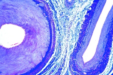 Mikropräparat - Arterie und Vene vom Säugetier, quer.