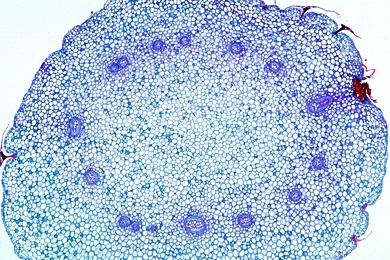 Mikropräparat - Dictyostele, Rhizom von Polypodium, quer