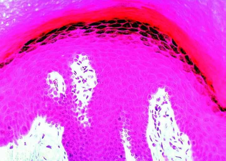 Mikropräparat - Haut des Menschen quer, (vertikal)